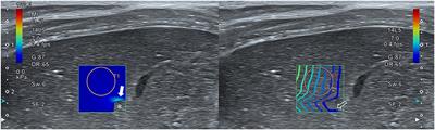 Effects of Confounding Factors on Liver Stiffness in Two-Dimensional Shear Wave Elastography in Beagle Dogs